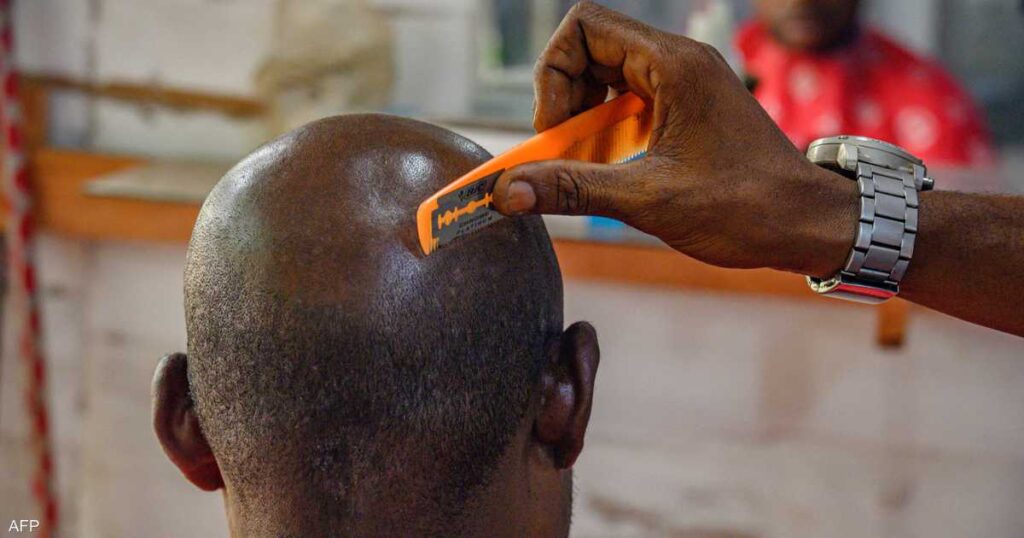 علماء يبتكرون علاجا جديدا قد ينهي مشكلة الصلع